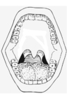 boca