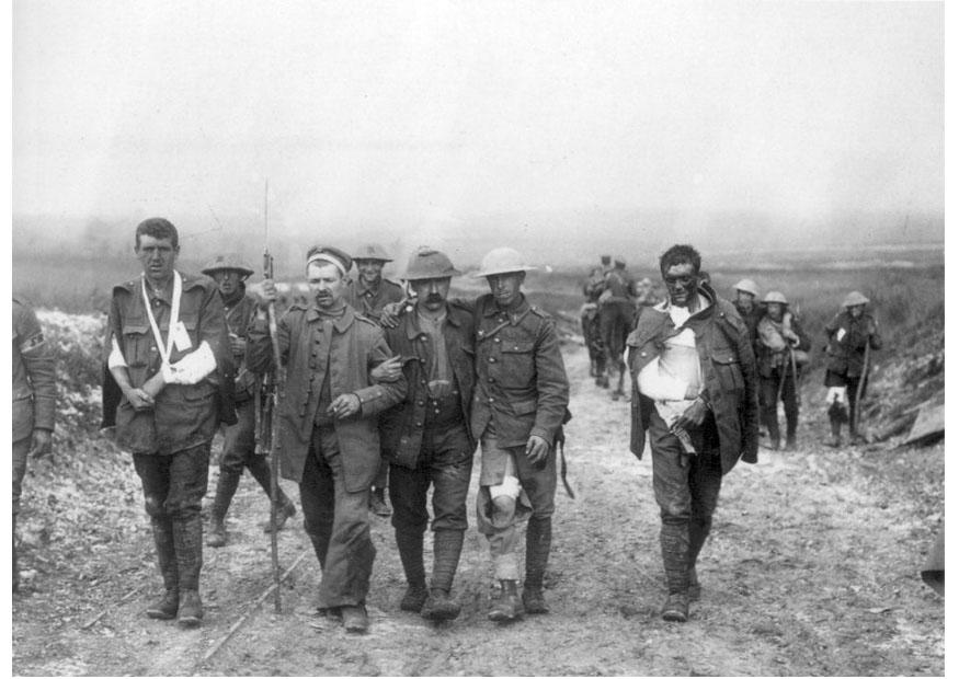 Foto soldados britÃ¢nicos feridos 