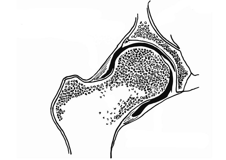 articulaA§A£o coxo-femoral Página para colorir articulaA§A£o coxo-femoral